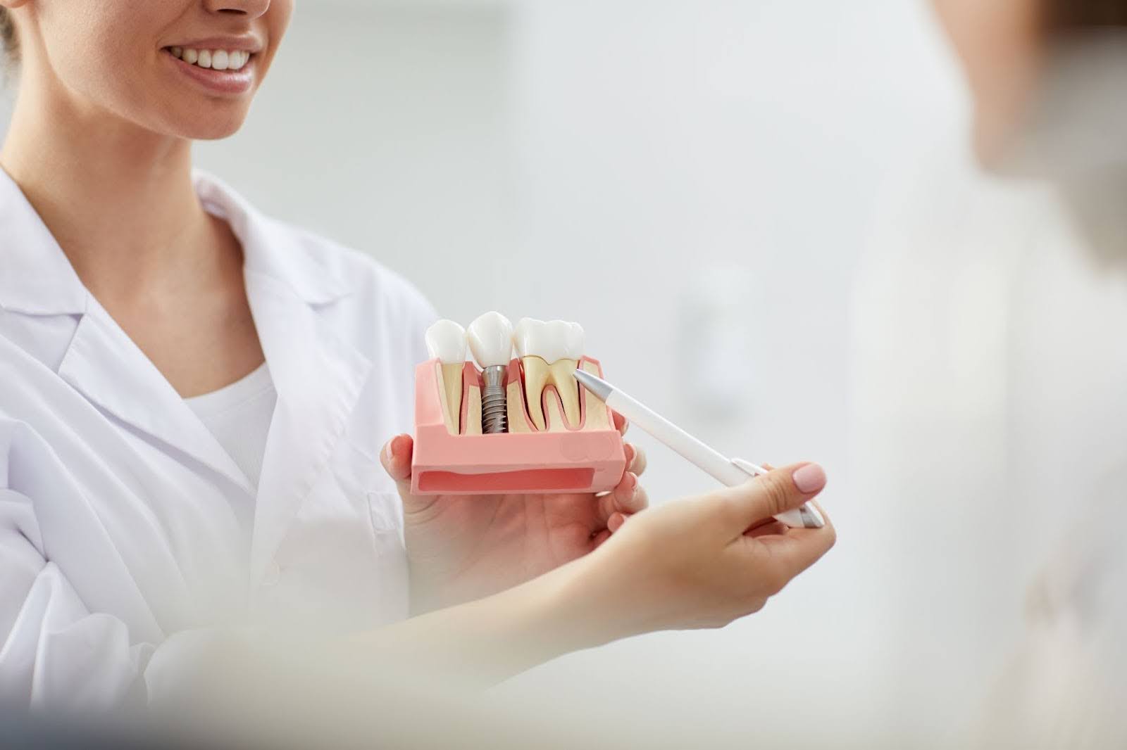 Understanding Osseointegration: The Key to Successful Dental Implants