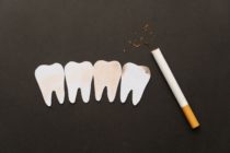 Dental Implants and Smoking: Risks, Effects, and Best Practices Image